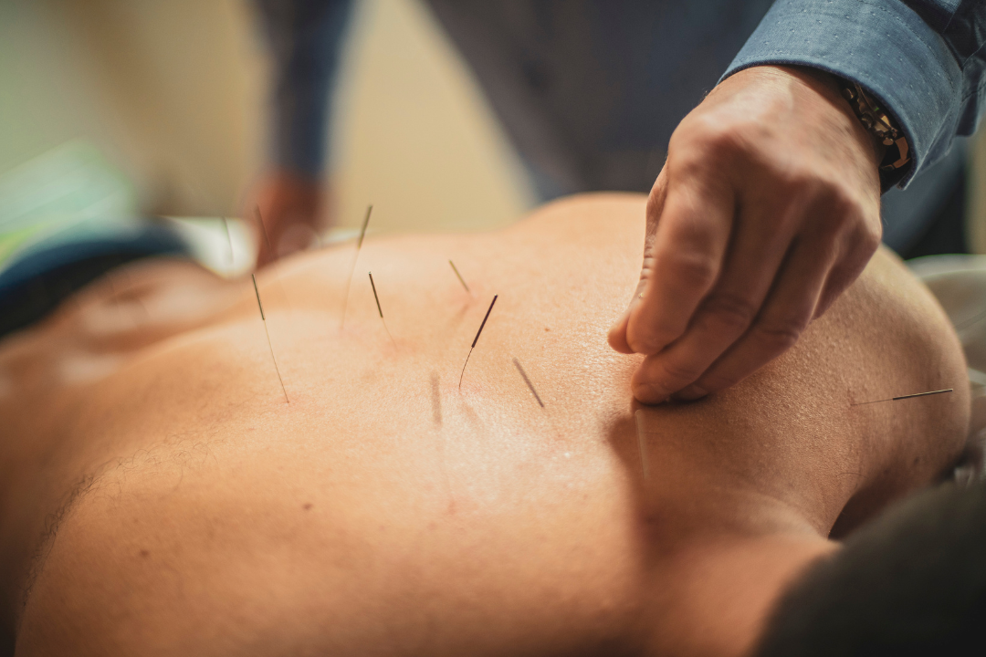 How does acupuncture work?